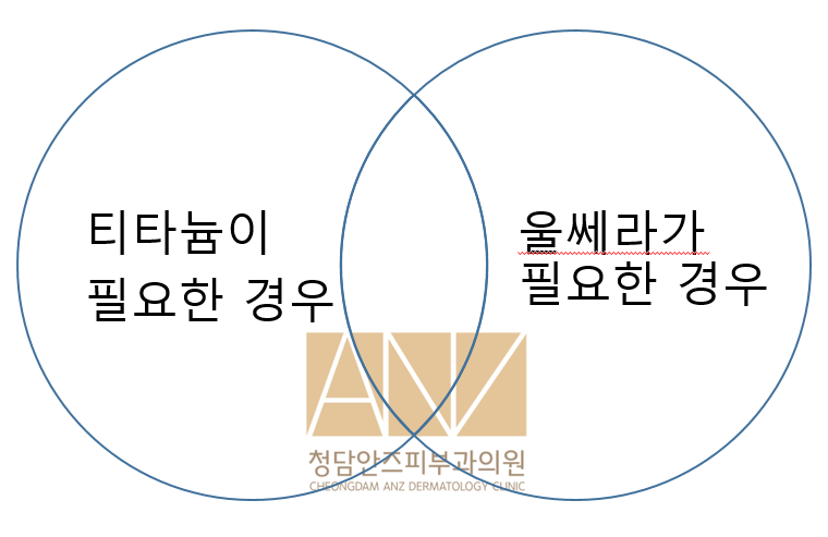 전참시에서 티타늄레이저가..!