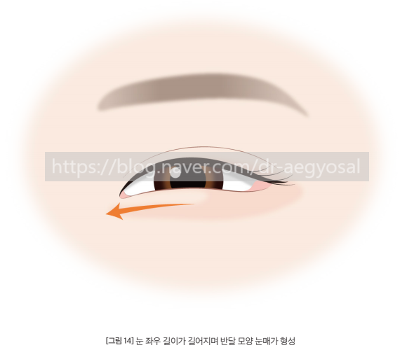 애교살의 장점 (애교살 운동하세요!) 사진 4
