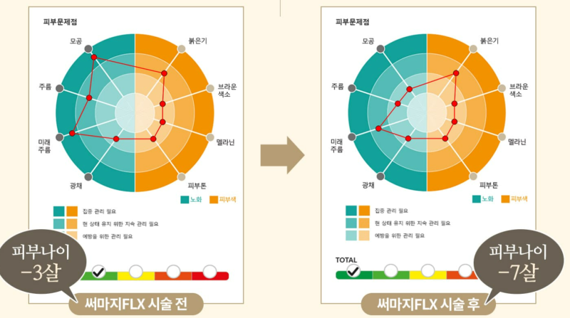 청담안즈 티써마지 후기 (2023.9) 사진 11