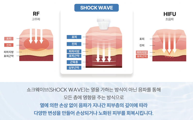 레비나스의 모든 것 (feat. 빠샤리프팅) 사진 5