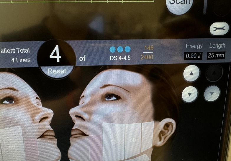 울쎄라 이렇게 하지 맙시다 진짜.. (점쎄라??)