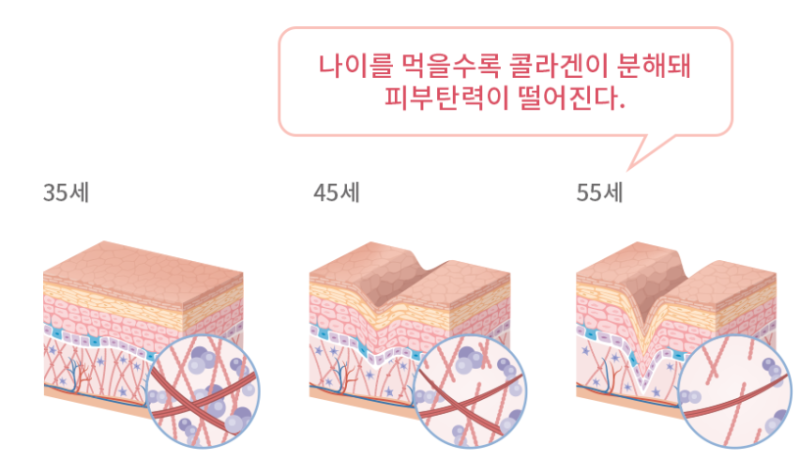 리프팅의 본질