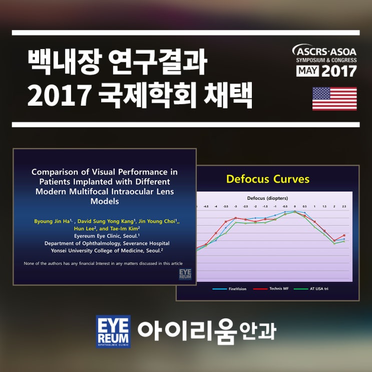 [백내장수술후기]세상이 달라진 기분