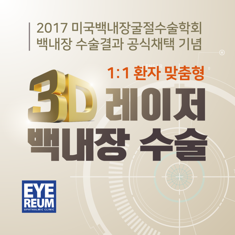 레이저장비를 이용한 백내장 수술, 이벤트