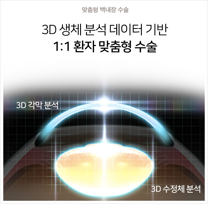 백내장 녹내장 황반변성, 설연휴 눈건강 관리법