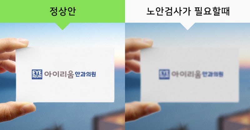 노안에 대한 모든 것! 노안수술 해야 하나요?