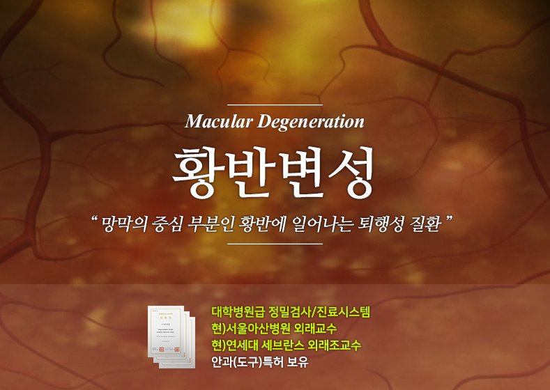 화창한 날씨! 자외선으로부터 내 눈 보호하기