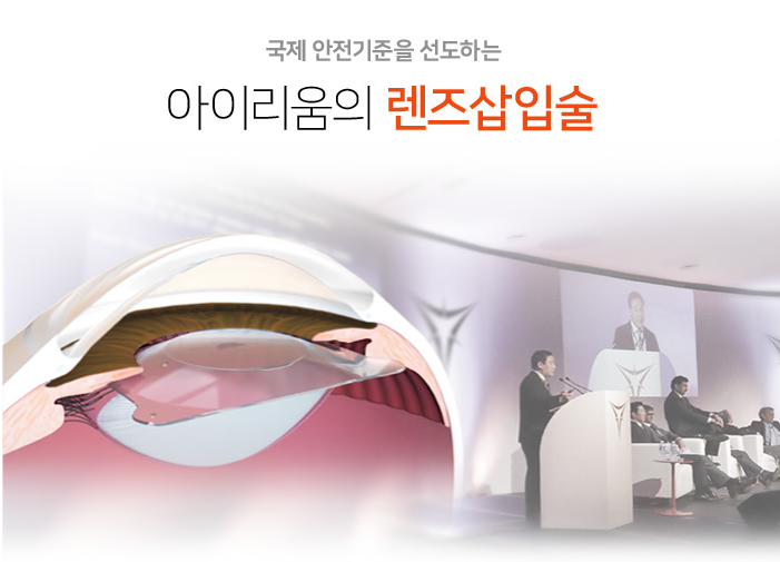 렌즈삽입 부작용 줄이기위한 꿀팁★