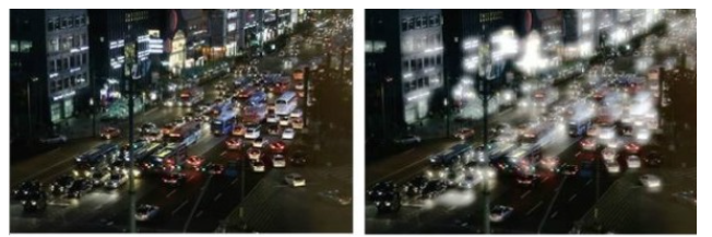 라섹비용 고민하는 이들은 '왜' 아이리움을 선택할까?