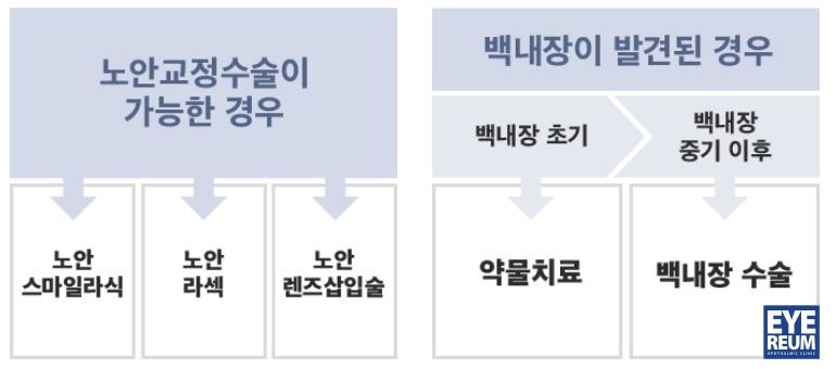 [아이리움안과 노안백내장클리닉] 노안, 언제 수술하는게 좋을까요?