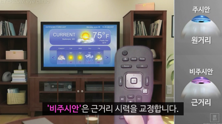 [아이리움안과 노안백내장클리닉] 노안, 언제 수술하는게 좋을까요?