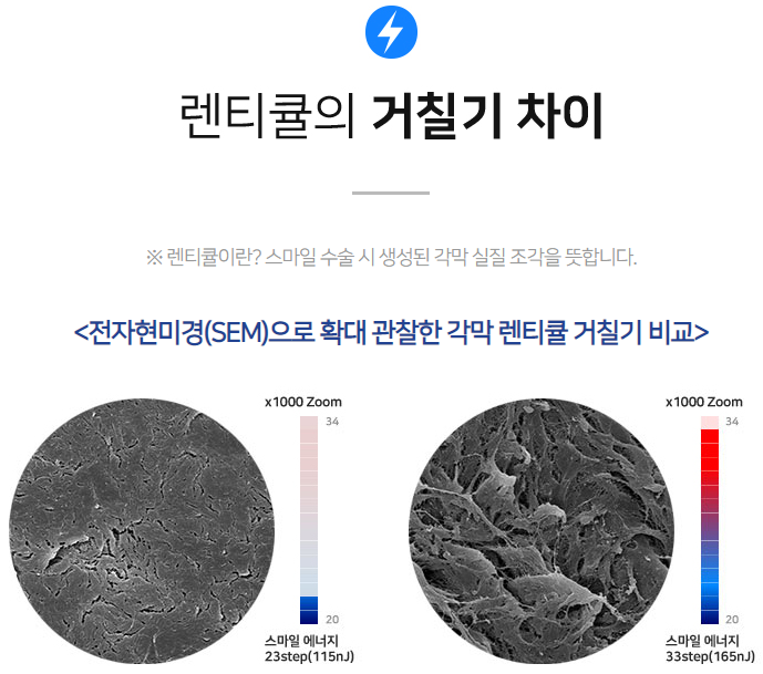 강남 아이리움 안과 군인라식혜택 확인