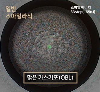 아이리움안과 스마일수술은 ‘로우에너지 스마일’입니다. 사진 4