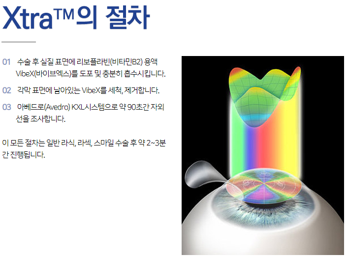 강남라섹안과가 찾은 라섹수술 후 근시 퇴행 억제 방안
