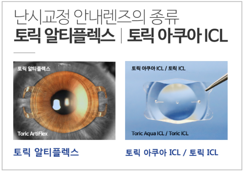토릭ICL렌즈삽입술, 학회서 발표한 가장 중요점?
