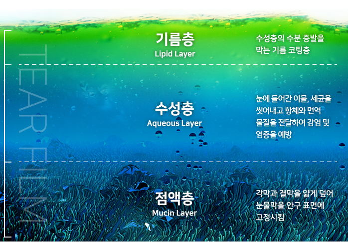 안구건조증IPL로 뻑뻑한 눈 벗어나자!