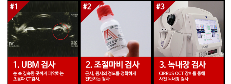 렌즈삽입술회복기간 아이리움은 다르다!