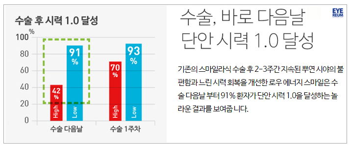 시력1.2가 현실이 되는 스마일라식!
