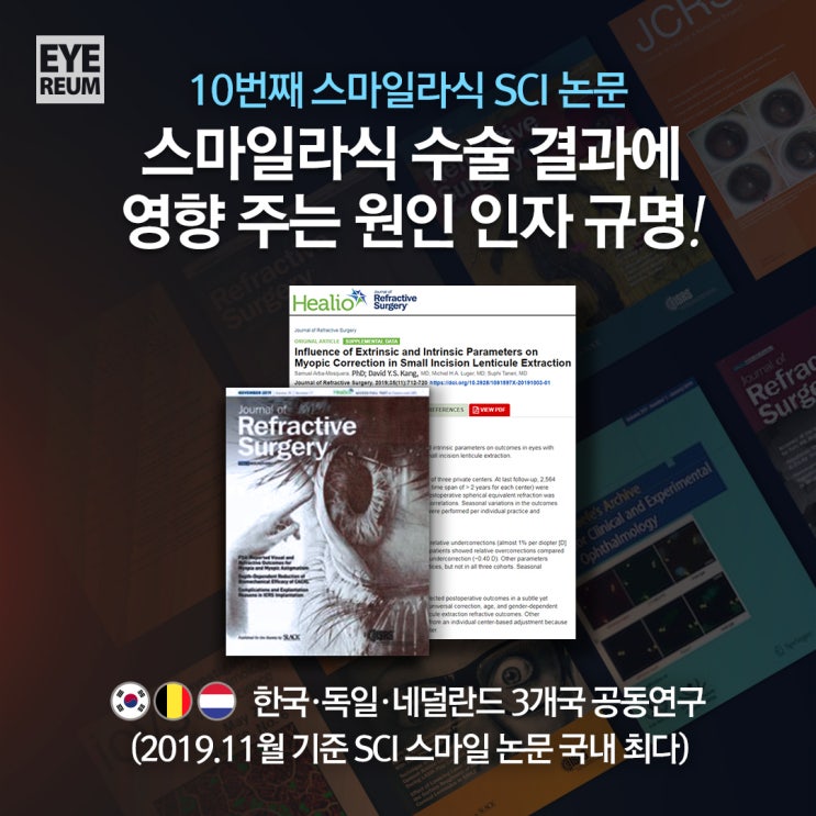 스마일수술 결과에 영향주는 원인인자 규명한 아이리움안과