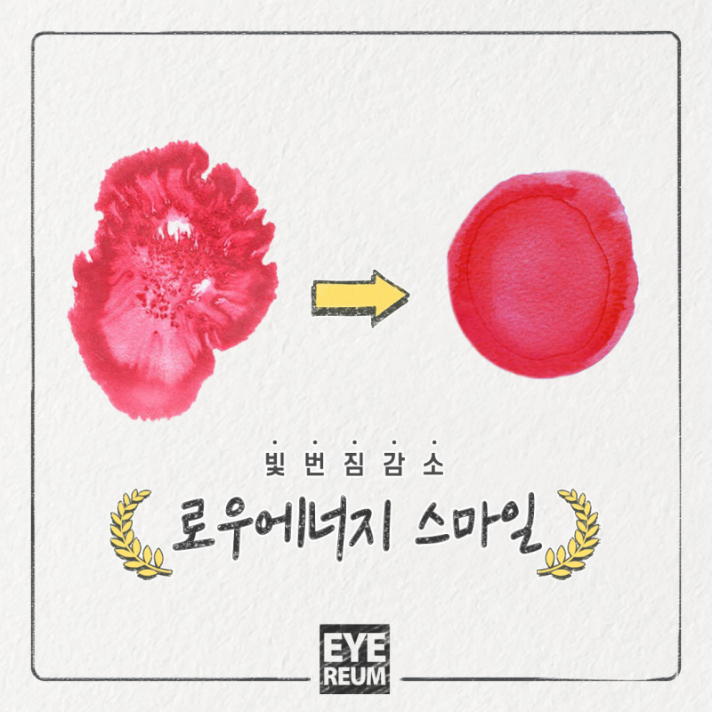 스마일라식비용은 내리고, 시력의 질은 올리고!