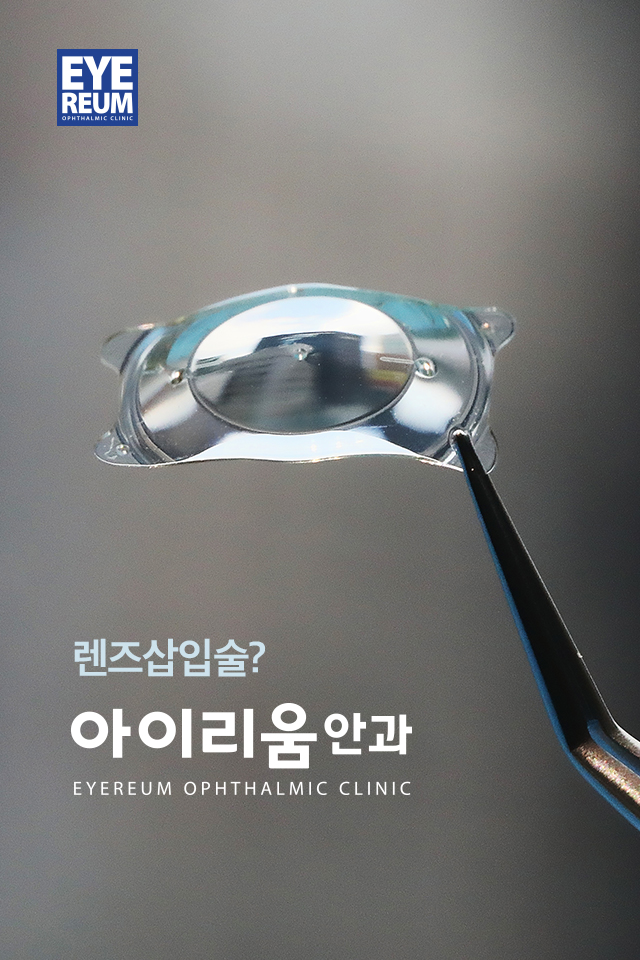 안내렌즈삽입술, 믿을 수 있는 의료진을 만나려면?