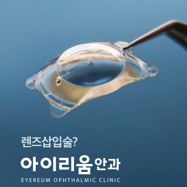 렌즈삽입술 비용, 실력까지 확실한 곳??
