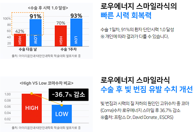 스마트라식, 똑똑한 로우에너지 스마일라식!