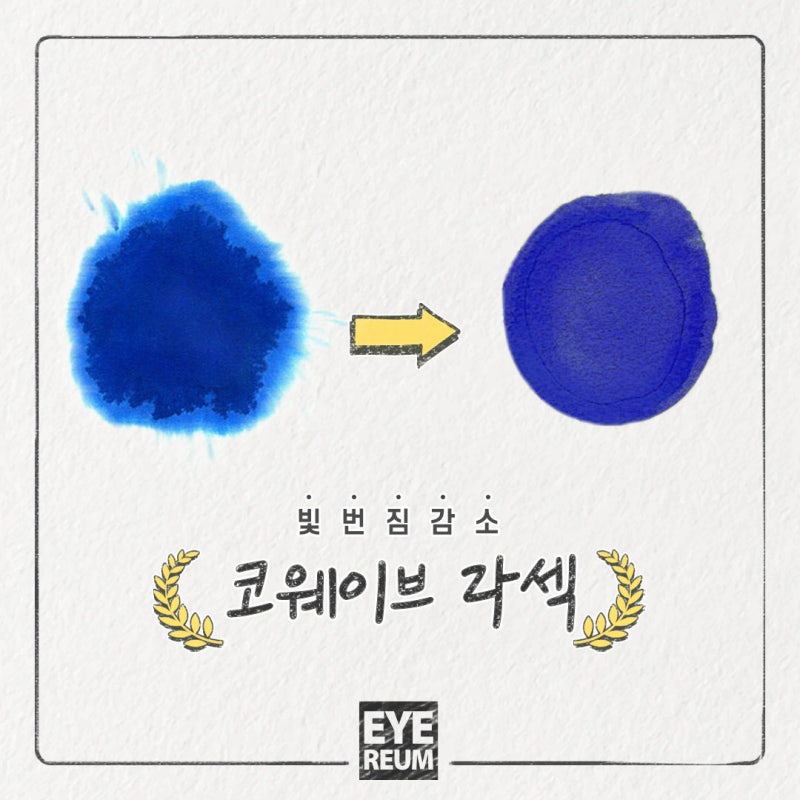 라섹수술후기 주인공 나야 나!!