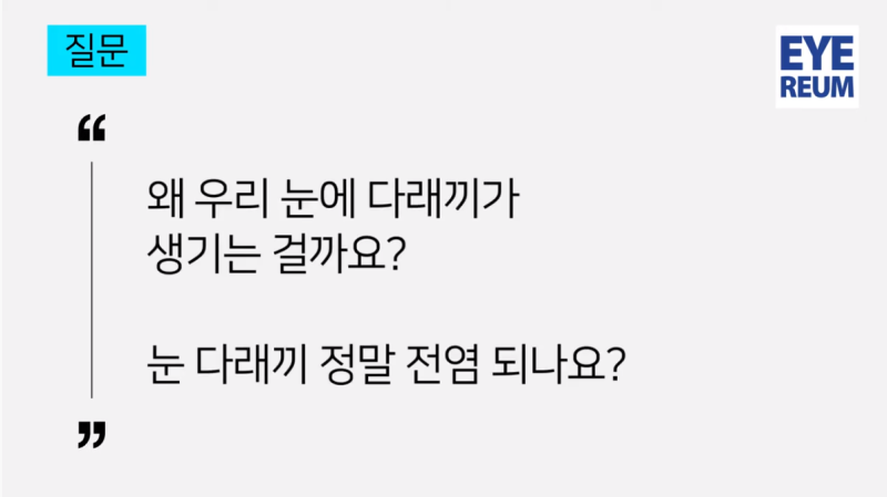 다래끼 전염된 사례가 있다?!
