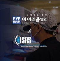 스마일라섹가격과 라식후기 확인해요 사진 13