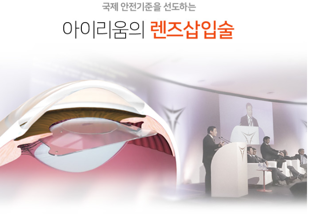 렌즈삽입술후기, 직접 확인해보세요~