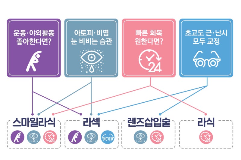 라식라섹차이 어렵지 않아요!