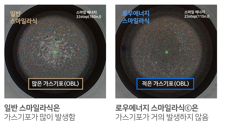 강남역라식 나에게 맞는 에너지로