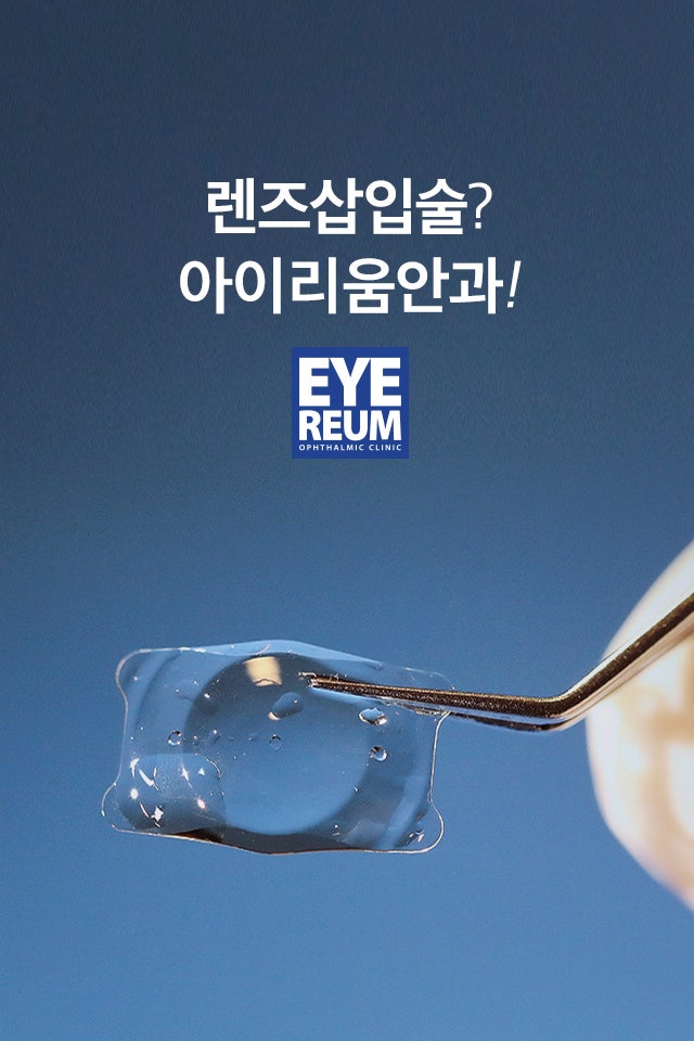 ICL렌즈삽입술 찾는 사람들, 이런 이유에서!