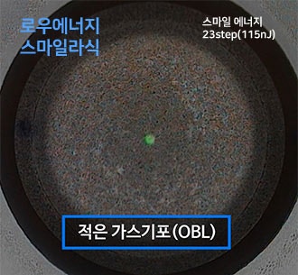 "회복 빠른 라식수술이 필요해!" -로우에너지 스마일라식을 찾는 사람들 사진 10