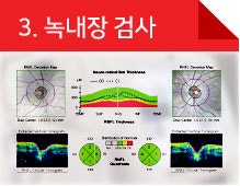 아이리움안과 렌즈삽입수술 후기 찾고 계신가요? 사진 6