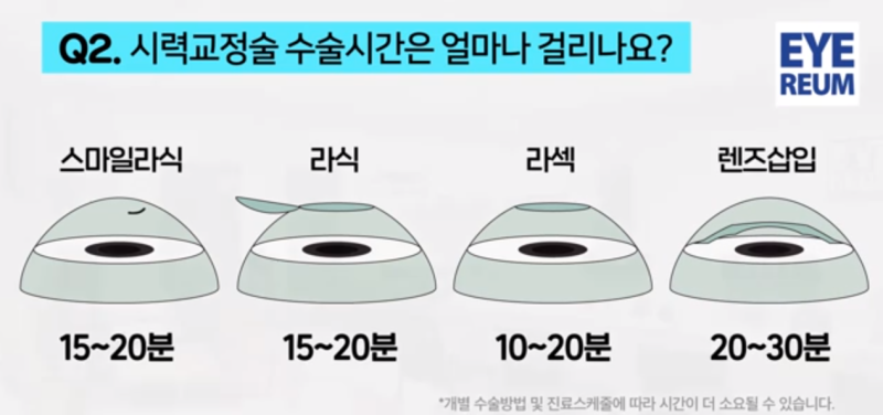 라식라섹을 계획하는 분들이 자주 묻는 베스트 질문 TOP 3!