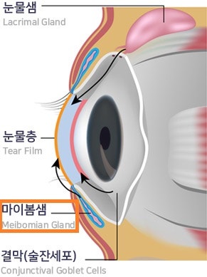 백내장, 수술하면 끝? NO! 철저한 관리가 시작되어야 할 때! - 백내장수술 후 주의사항-