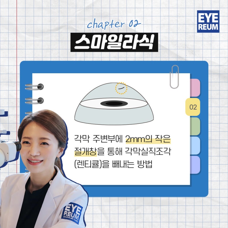 스마일라식, 진정한 맞춤형 수술을 위해서는?