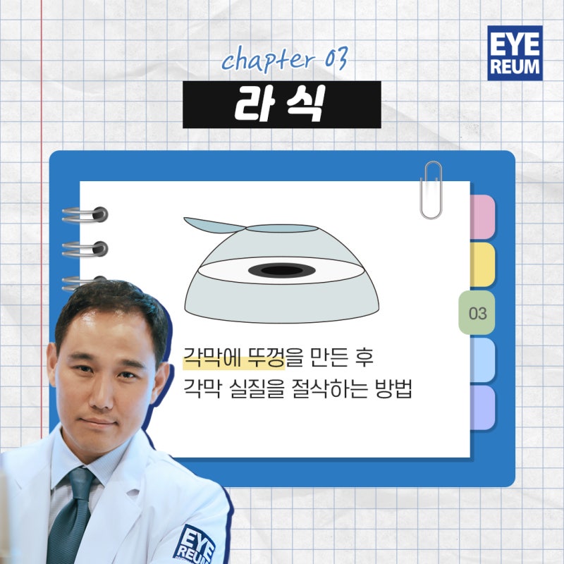 라식라섹비교, 더 좋은 수술은?