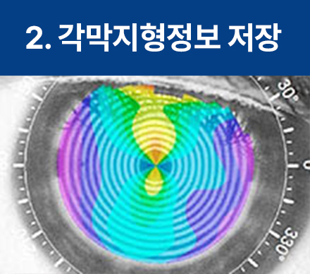 강남라섹 병원 ! 어디가? 사진 7