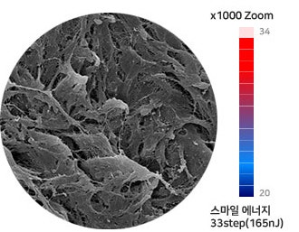 라식라섹수술도 1:1맞춤으로! 사진 4