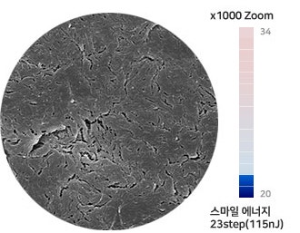 라식라섹수술도 1:1맞춤으로! 사진 5