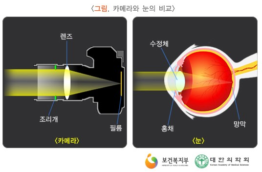 백내장수술방법,ㄱ(과정)부터 수술시간,ㅎ(후기)까지