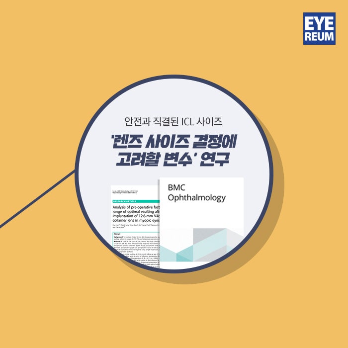 ICL렌즈삽입술, 렌즈종류 및 특징 사진 5