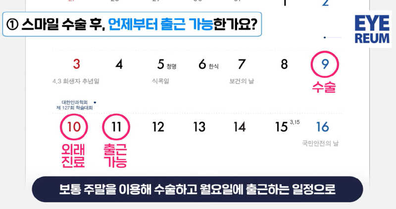 스마일라식회복 에 영향을 미치는 ㅇㅇㅇ