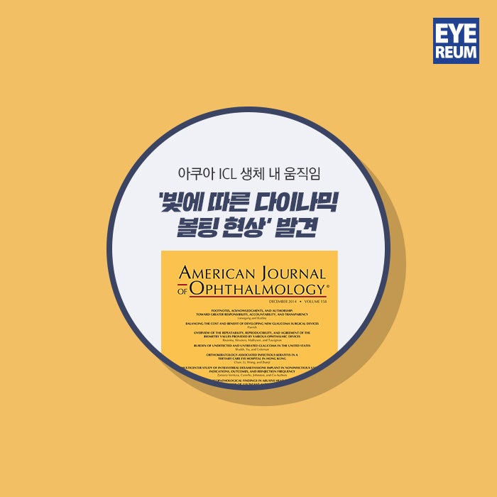 ICL수술 -렌즈삽입술 안전한 수술을 위해 사진 3