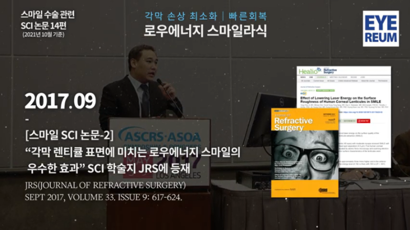 스마일수술 결과하면 왜 아이리움 안과일까