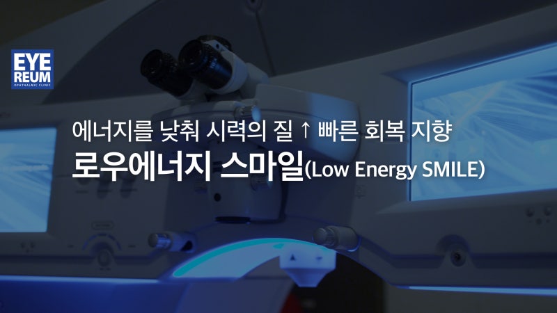 스마일라식 병원 '이것'만은 체크하세요