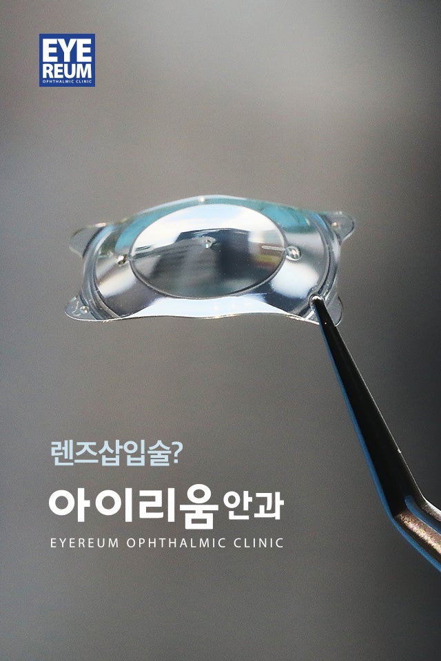 렌즈삽입술가격 만큼 중요한 것은?